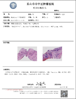 我院成功开展天花板级操作 --超声引导下胰腺病变穿刺活检术(图3)